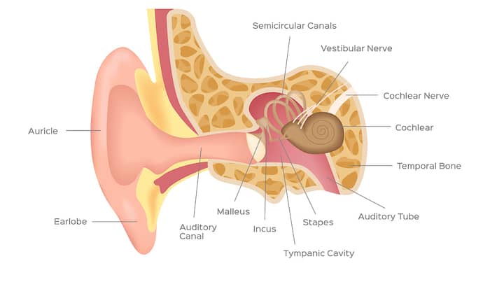 hearing loss